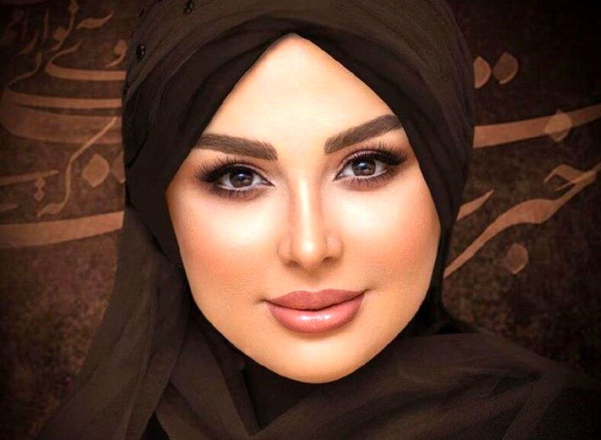 عکس لورفته وحشتناک از صورت ترکیده نیوشا ضیغمی ! | تغییر چهره نیوشا ضیغمی بعد از عمل